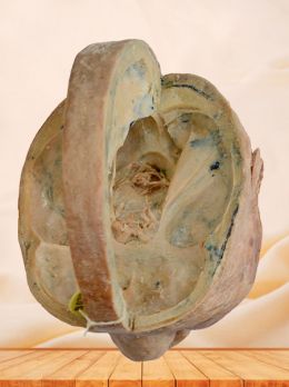 Brain with dura plastinated specimen