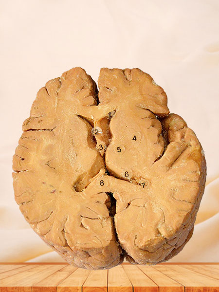 Horizontal section of human plastinated brain