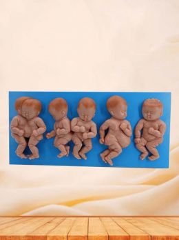 Deformed Fetus Simulation Model