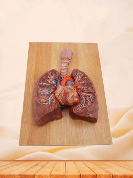 Lung Anatomy Model