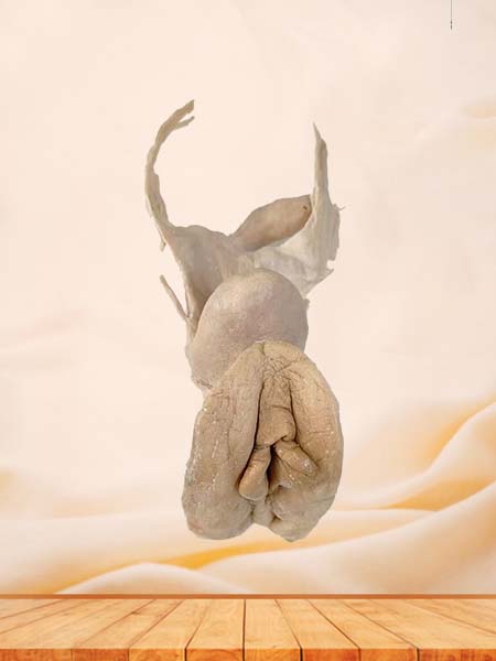 Female genital ograns in combination with rectum and perineum specimen