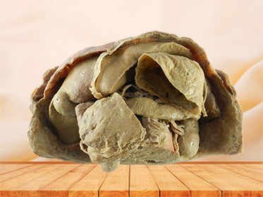 Abdominal viscera and caeliac trunk