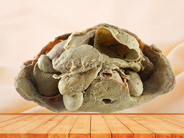 Abdominal viscera and caeliac trunk for sale