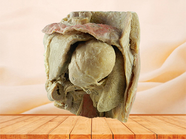 Abdominal viscera and caeliac trunk medical specimen