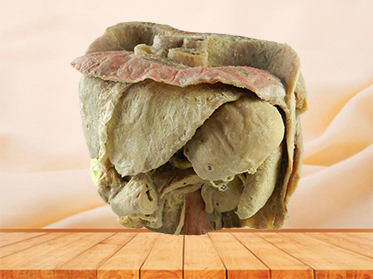 Abdominal viscera and caeliac trunk plastination