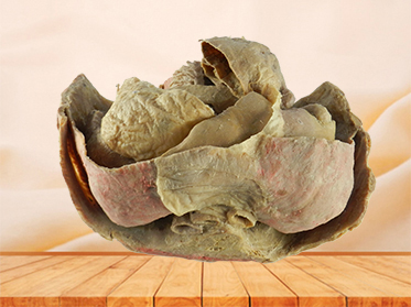 Abdominal viscera and caeliac trunk specimen