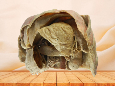 Abdominal viscera and caeliac trunk teaching specimen