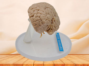 Artery of cerebral hemisphere