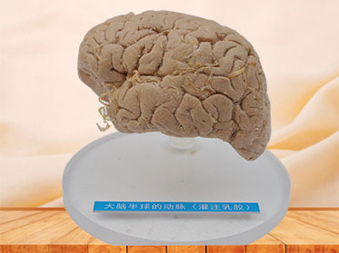 Artery of cerebral hemisphere plastinated specimen