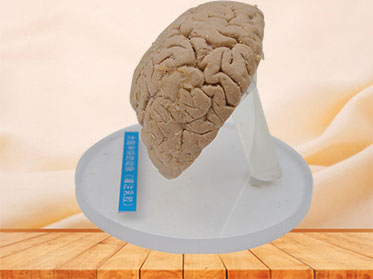 Artery of cerebral hemisphere plastination