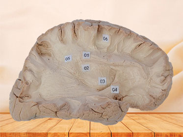 Association fibe  of cerebral hemisphere plastinated specimen