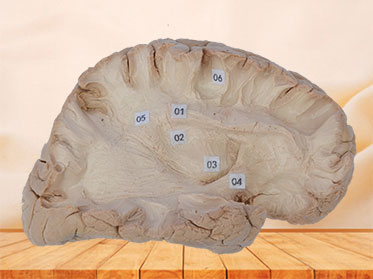 Association fiber of cerebral hemisphere