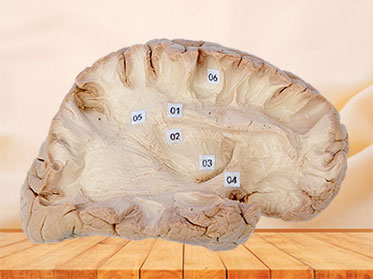 Association fiber of cerebral hemisphere plastination