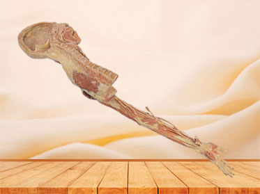Brachial plexus and its branches plastinated specimen