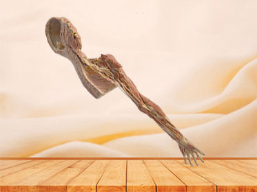 Brachial plexus and its branches plastination