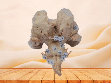 Brain stem