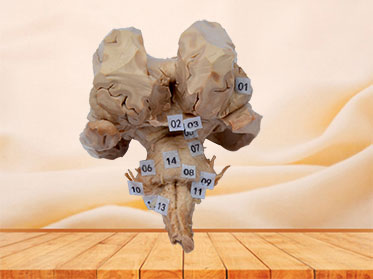 Brain stem plastinated specimen