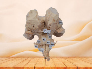 Brain stem plastination specimen
