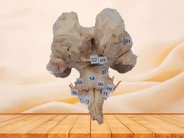 Brain stem plastrination