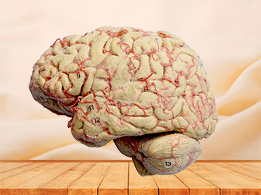 Cerebral hemisphere and brain plastinated specimen