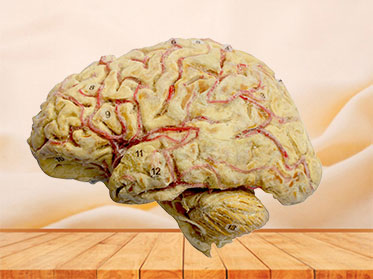Cerebral hemisphere and brain stem