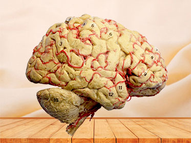 Cerebral hemisphere and brain stem plastination