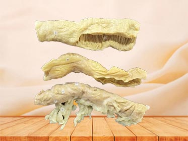 Comparison of ileum colon colon plastinated specimen