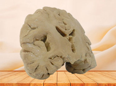 Coronal section of brain plastinated specimen