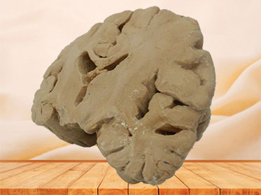 Coronal section of brain plastination