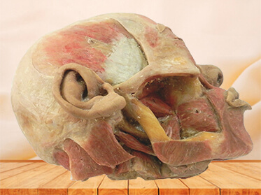 Deep muscles of mastication
