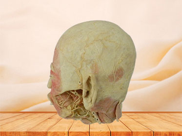 Deeper vascular nerve of head