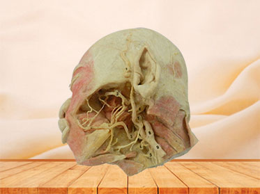 Deeper vascular nerve of head plastination