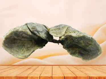 Double lungs without heart