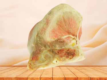Female internal genital organs medical specimen