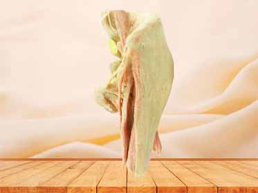 Female internal genital organs plastinated specimen