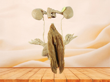 Female urogenital system plastination specimen