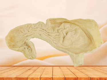 Gastric mucosa plastinated specimen