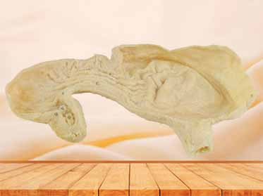 Gastric mucosa plastination