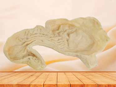 Gastric mucosa specimen