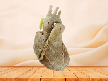 Heart with coronary vessels