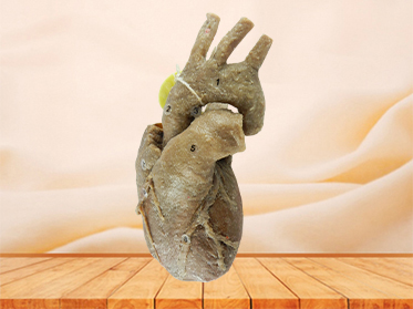 Heart with coronary vessels for sale