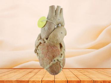 Heart with coronary vessels plastinated specimen