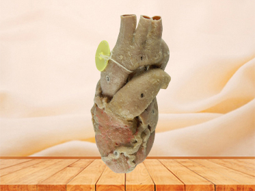 Heart with coronary vessels plastination