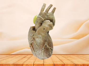 Heart with coronary vessels specimen