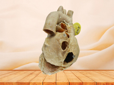 Heart with coronary vessels specimen for sale