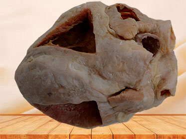 Heart（Heart specimen with ventricles opened to expose the valves）