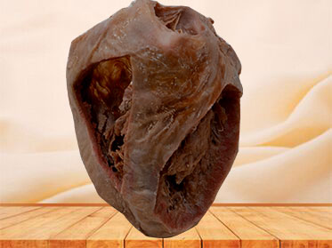 Heart（Heart specimen with ventricles opened to expose the valves）plastination specimen