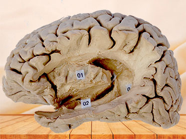 Hippocampal formation plastinated specimen