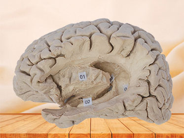 Hippocampal formation plastination