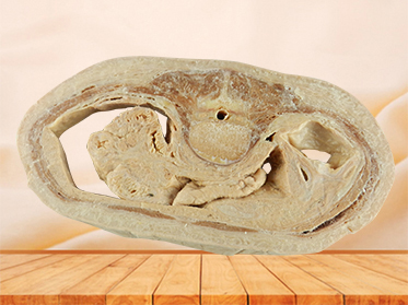 Horizontal slices of com plete female body